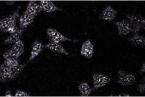 HeLa (STAT6 抗体  (C-Term))
