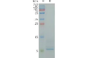 SDS-PAGE (SDS) image for CD9 (CD9) (AA 112-195) protein (His tag) (ABIN6964169)