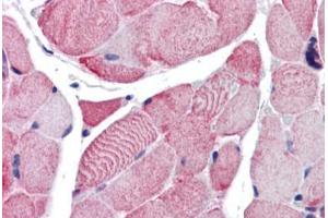 Human Skeletal Muscle (formalin-fixed, paraffin-embedded) stained with ACTB antibody ABIN337375 at 10 ug/ml followed by biotinylated goat anti-rabbit IgG secondary antibody ABIN481713, alkaline phosphatase-streptavidin and chromogen. (beta Actin 抗体  (C-Term))