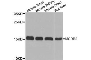 Western blot analysis of extracts of various cell lines, using MSRB2 antibody. (MSRB2 抗体)