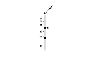 Anti-NPTX2 (C-term) at 1:1000 dilution + H. (NPTX2 抗体  (C-Term))