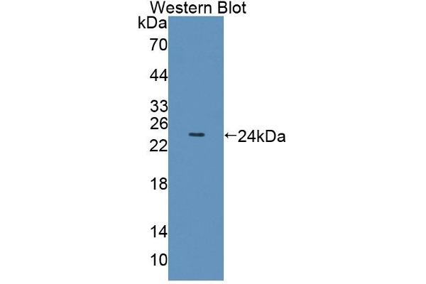 Olfactomedin 3 anticorps  (AA 24-198)