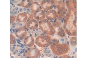 Used in DAB staining on fromalin fixed paraffin- embedded Kidney tissue (SH2B3 抗体  (AA 225-447))