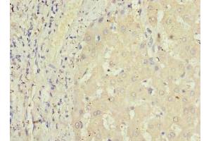 Immunohistochemistry of paraffin-embedded human liver tissue using ABIN7164457 at dilution of 1:100 (GPR146 抗体  (AA 301-333))