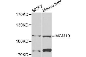 Western blot analysis of extracts of MCF7 and mouse liver cells, using MCM10 antibody. (MCM10 抗体)