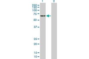 Western Blot analysis of TBCD expression in transfected 293T cell line by TBCD MaxPab polyclonal antibody.
