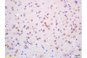 Formalin-fixed and paraffin embedded rat brain labeled with Rabbit Anti CDC10/Septin 7 Polyclonal Antibody, Unconjugated (ABIN873015) at 1:200 followed by conjugation to the secondary antibody and DAB staining (Septin 7 抗体  (AA 201-300))