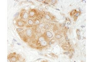 Immunohistochemistry (IHC) image for anti-GIT1 (GIT1) (AA 375-425) antibody (ABIN7453710)
