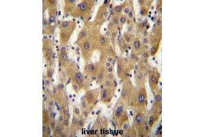 Immunohistochemistry (IHC) image for anti-P Antigen Family, Member 5 (Prostate Associated) (PAGE5) antibody (ABIN2996953) (PAGE5 抗体)