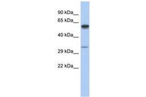 Image no. 1 for anti-Zinc Finger, DHHC-Type Containing 24 (ZDHHC24) (C-Term) antibody (ABIN6743943) (ZDHHC24 抗体  (C-Term))