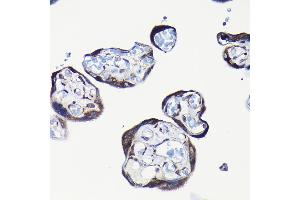 Immunohistochemistry (IHC) image for anti-Ribosomal Protein L23A (RPL23A) (AA 1-156) antibody (ABIN1682576)