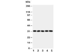 Western blot testing of LOX-1 antibody and Lane 1:  HeLa (OLR1 抗体  (N-Term))