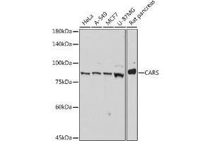 Western blot analysis of extracts of various cell lines, using CARS antibody (ABIN7266624) at 1:1000 dilution. (CARS 抗体)