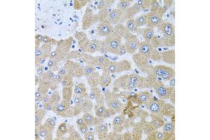 Immunohistochemistry of paraffin-embedded human liver injury using POMGNT1 antibody. (POMGNT1 抗体)