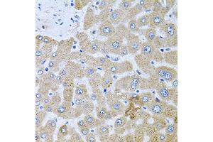 Immunohistochemistry of paraffin-embedded human liver injury using POMGNT1 antibody.