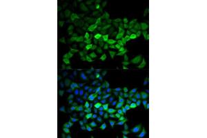 Immunofluorescence analysis of HeLa cells using UBE2C antibody. (UBE2C 抗体  (AA 1-179))
