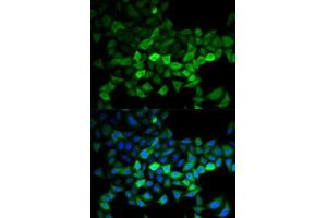 Immunofluorescence analysis of HeLa cells using UBE2C antibody. (UBE2C 抗体  (AA 1-179))