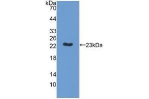 Detection of Recombinant MPP6, Human using Polyclonal Antibody to Membrane Protein, Palmitoylated 6 (MPP6) (MPP6 抗体  (AA 331-503))