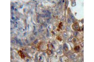 Used in DAB staining on fromalin fixed paraffin-embedded lung tissue (Podoplanin 抗体  (AA 23-143))
