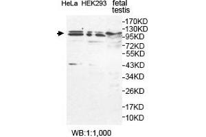 Western blot analysis of feteal testis, HeLa and HEK293 cell lysates, using USP29 antibody. (USP29 抗体  (AA 15-215))