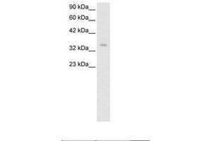 Image no. 2 for anti-Zinc Finger Protein 391 (ZNF391) (AA 66-115) antibody (ABIN6735795) (ZNF391 抗体  (AA 66-115))