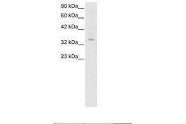 ZNF391 抗体  (AA 66-115)