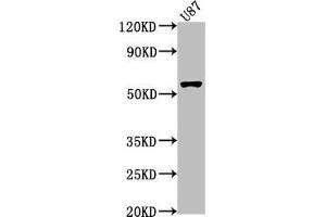Western Blot Positive WB detected in: U87 whole cell lysate All lanes: RORB antibody at 1:1000 Secondary Goat polyclonal to rabbit IgG at 1/50000 dilution Predicted band size: 54, 53 kDa Observed band size: 54 kDa (RORB 抗体  (AA 1-269))