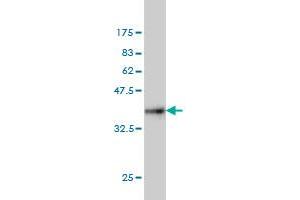 Western Blot detection against Immunogen (36. (Centrin 1 抗体  (AA 1-100))