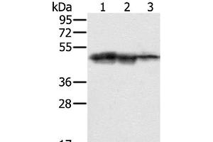 Western Blot analysis of Hepg2, K562 and Jurkat cell using SMARCB1 Polyclonal Antibody at dilution of 1:400 (SMARCB1 抗体)