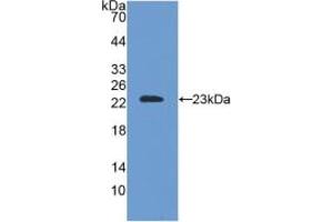 Western blot analysis of recombinant Mouse SOD2. (SOD2 抗体  (AA 25-222))
