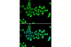 Immunofluorescence analysis of A549 cell using HSPA14 antibody. (HSPA14 抗体)