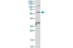 IL6R MaxPab polyclonal antibody. (IL-6 Receptor 抗体  (AA 1-468))