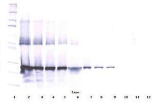Image no. 3 for anti-WNT1 Inducible Signaling Pathway Protein 2 (WISP2) antibody (ABIN465385) (WISP2 抗体)