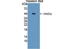 Detection of Recombinant API5, Human using Polyclonal Antibody to Apoptosis Inhibitor 5 (API5)