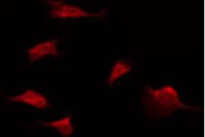 ABIN6274598 staining Hela by IF/ICC. (LI Cadherin 抗体  (Internal Region))