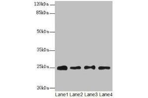 Western blot All lanes: RPS8 antibody at 6 μg/mL Lane 1: HL60 whole cell lysate Lane 2: THP-1 whole cell lysate Lane 3: 293T whole cell lysate Lane 4: Mouse liver tissue Secondary Goat polyclonal to rabbit IgG at 1/10000 dilution Predicted band size: 25 kDa Observed band size: 25 kDa (RPS8 抗体  (AA 2-208))