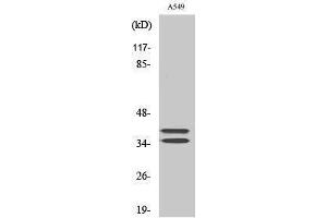 Western Blotting (WB) image for anti-Linker For Activation of T Cells (LAT) (Tyr660) antibody (ABIN3175823) (LAT 抗体  (Tyr660))