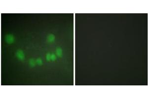 Immunofluorescence analysis of HUVEC cells, using CDC2 antibody. (CDK1 抗体  (Internal Region))