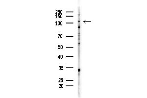 Western blot analysis of lysates from COLO205 cells(heat-shock,45 min treatment), using BR Antibody at 1/1000 dilution.