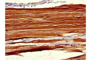 Immunohistochemistry of paraffin-embedded human skeletal muscle tissue using ABIN7158320 at dilution of 1:100 (LHFPL5 抗体  (AA 46-99))