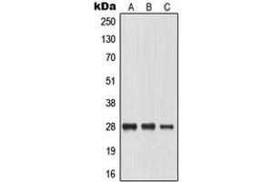 Western blot analysis of Aquaporin 0 expression in HeLa (A), SP2/0 (B), PC12 (C) whole cell lysates.