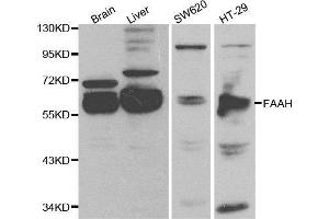 Western blot analysis of extracts of various cell lines, using FAAH antibody. (FAAH 抗体  (AA 450-579))