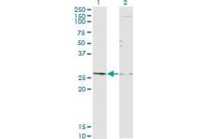 Western Blot analysis of TGIF2 expression in transfected 293T cell line by TGIF2 monoclonal antibody (M16A), clone 2D4. (TGIF2 抗体  (AA 1-237))