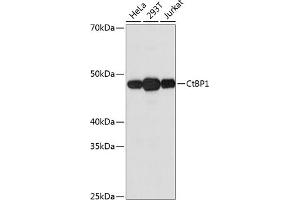 Western blot analysis of extracts of various cell lines, using CtBP1 Rabbit mAb (ABIN7265976) at 1:1000 dilution. (CTBP1 抗体)