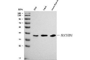 Western blot analysis of SLC35D1 using anti-SLC35D1 antibody (ABIN7599305).