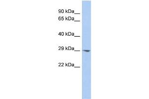 WB Suggested Anti-ECHDC2 Antibody Titration:  0. (ECHDC2 抗体  (Middle Region))