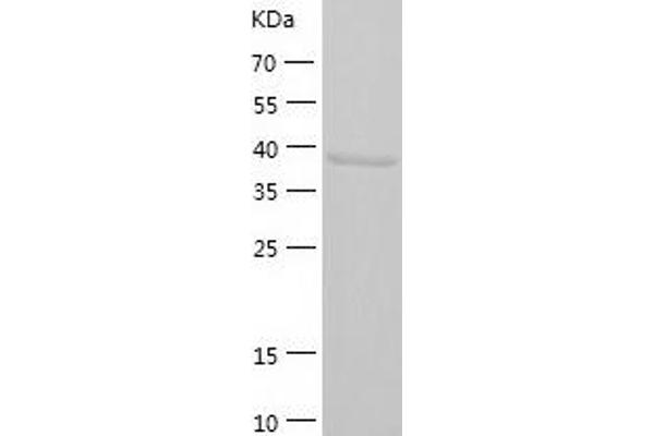 CREBZF Protein (AA 1-354) (His tag)