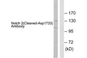 Western blot analysis of extracts from 293 cells treated with TNF-a (20ng/ml, 30mins), using Notch 2 (cleaved-Asp1733) antibody. (NOTCH2 抗体  (Cleaved-Asp1733))