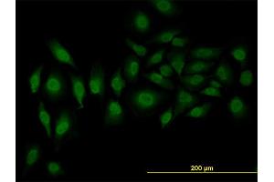 Immunofluorescence of monoclonal antibody to SFRS3 on HeLa cell. (SRSF3 抗体  (AA 1-85))