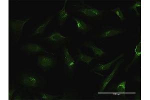 Immunofluorescence of purified MaxPab antibody to FTL on HeLa cell.